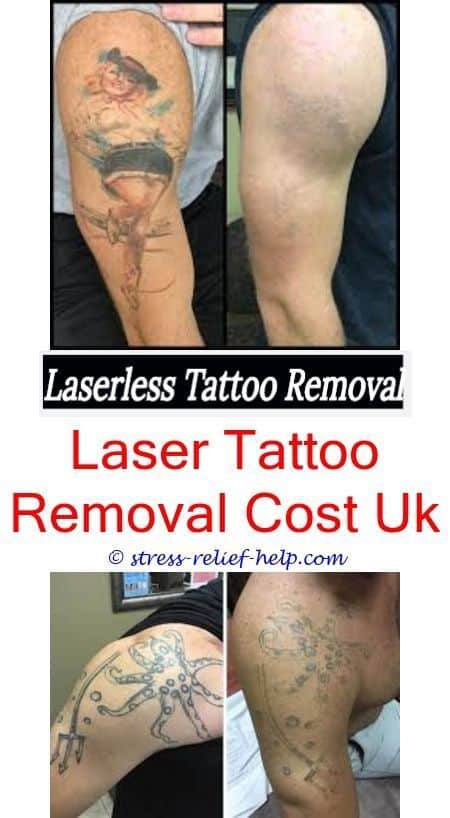How long does one session of tattoo removal take.How to remove ...