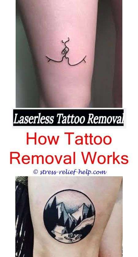 How much do laser tattoo removal technicians make.How much do tattoo ...