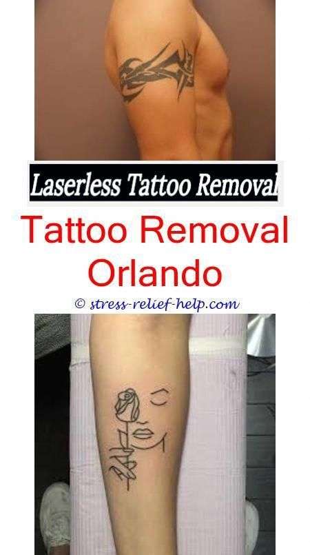 How much do laser tattoo removal technicians make.How to start your own ...