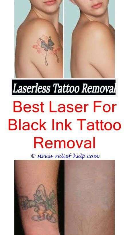 How much do tattoo removers make.How much does tattoo removal cost in ...