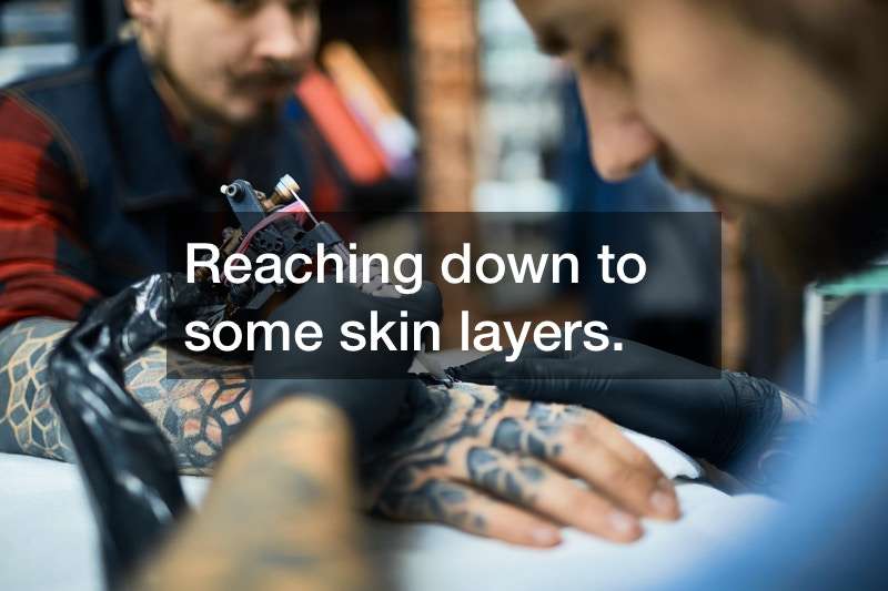 How Tattoo Removal School Can Help You Become a Better Tattoo Artist