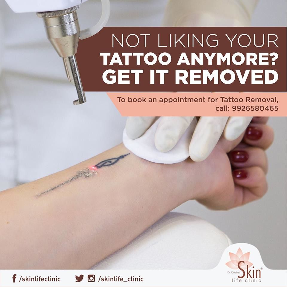 how to become a tattoo removal specialist