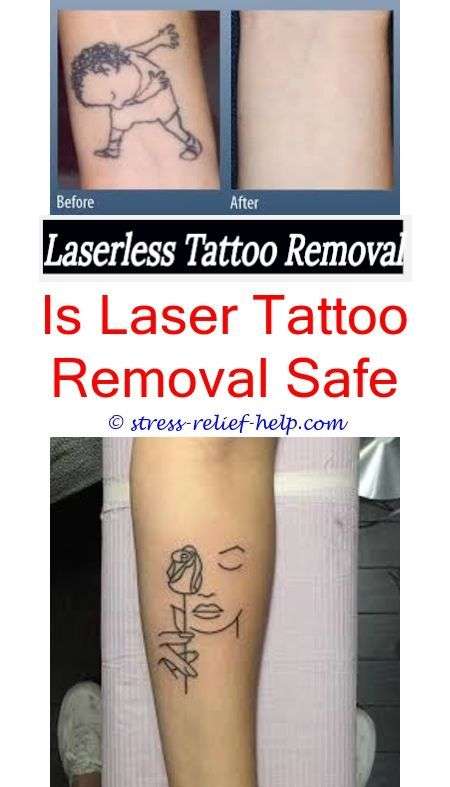 How to easily remove fake tattoos.Does removing a tattoo ...