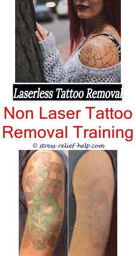 How to remove a tattoo.How much is tattoo removal in australia.How much ...