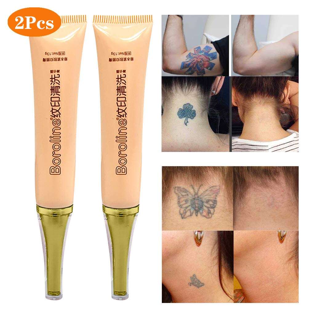 How To Remove Permanent Tattoo At Home