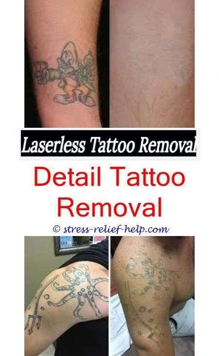 How to remove press on tattoos.How much is tattoo removal ...