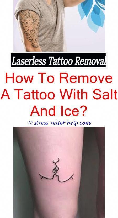 How to remove tattoo from skin at home.How much does a tattoo removal ...