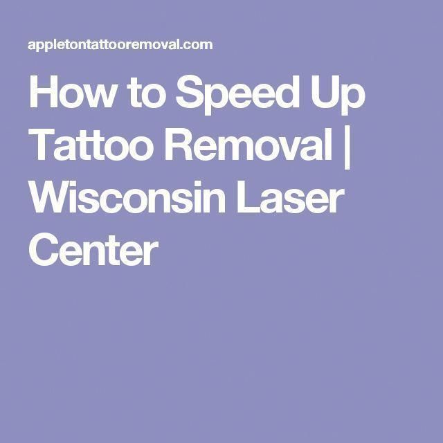How to Speed Up Tattoo Removal