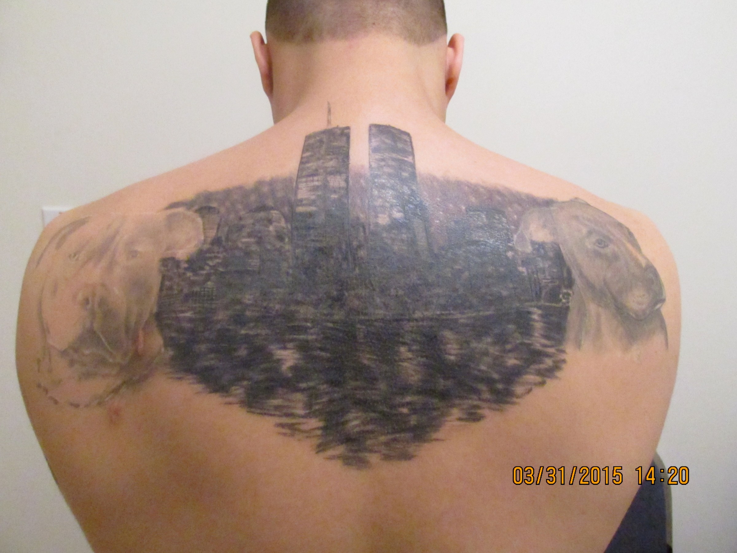 IMG_2113  Brooklyn laser tattoo removal