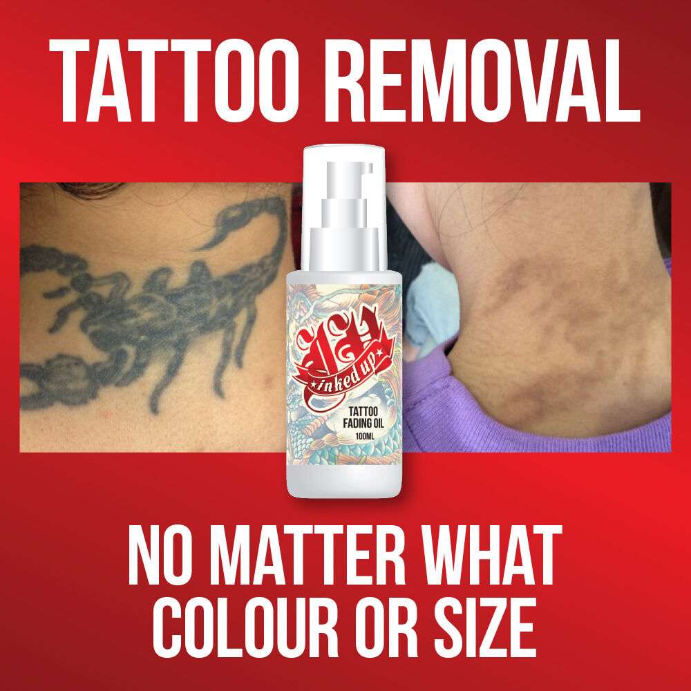 INKED UP TATTOO FADING OIL  NO NEED LASER REMOVE TATTOO ...