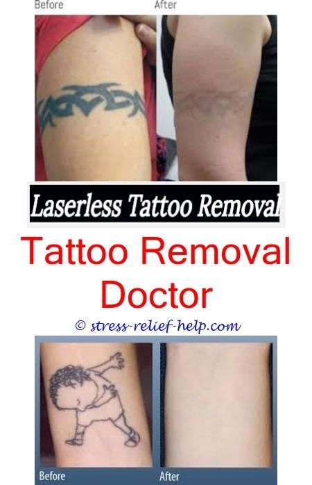 Invisible Ink Tattoo Removal Cost