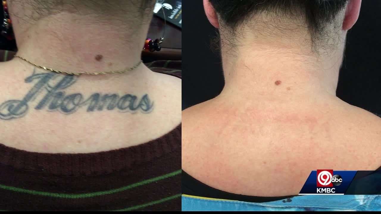 Invisible Ink Tattoo Removers Kansas City Mo