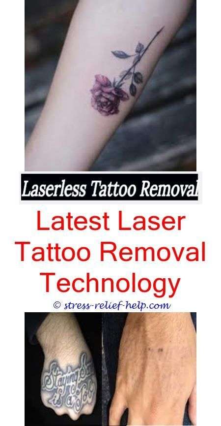 is laser tattoo removal safe is there a way to remove ...