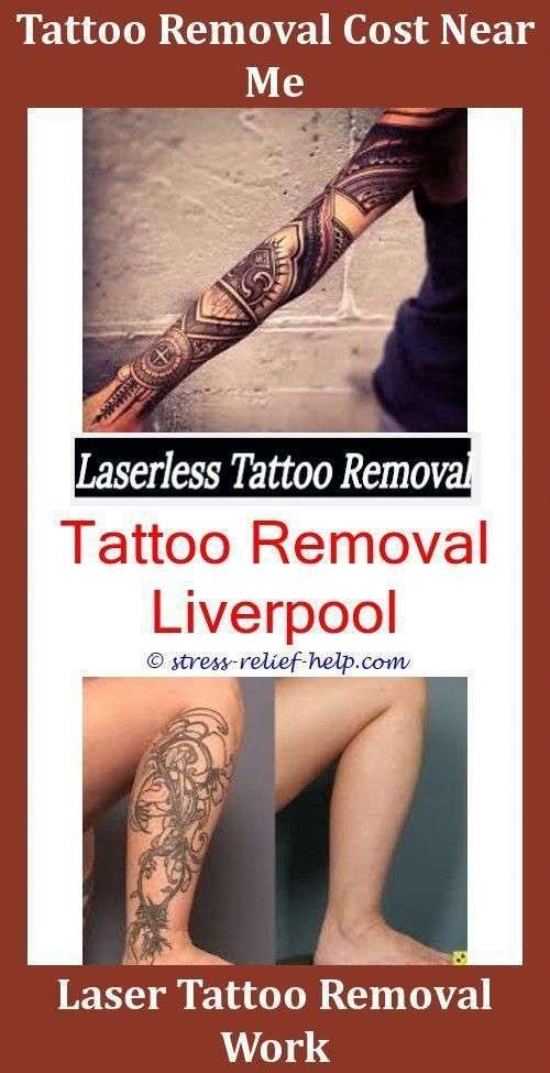 Is Laser Tattoo Removal Safe Tattoo Removal Blisters,tattoo kits can ...