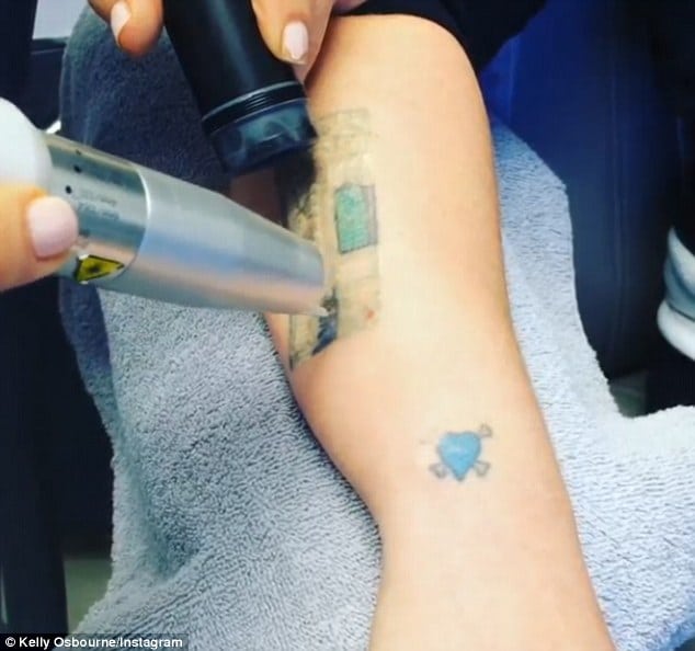 Kelly Osbourne films the start of her painful process to remove her ...