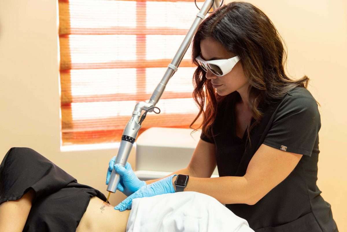 Laser Hair Removal in Northern California