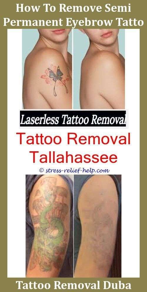 Laser Tattoo Rejuvi Tattoo Removal Cream Price Does Tattoo ...