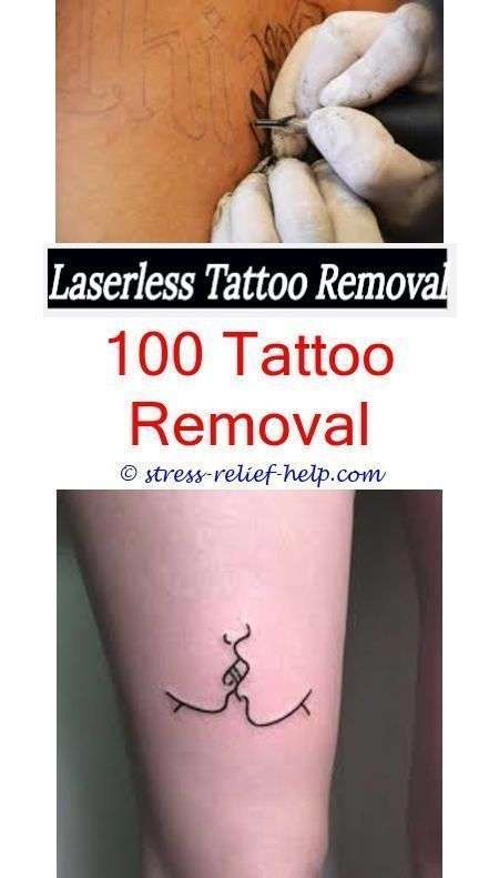 laser tattoo removal cost how to remove permanent tattoo from skin at ...