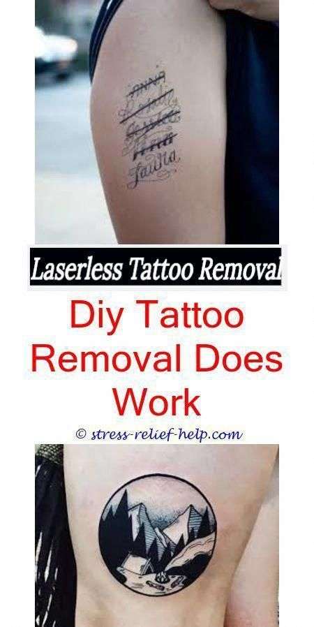 Laser tattoo removal los angeles.Tattoo removal industry.How do i ...
