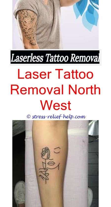 laser tattoo removal near me how much does a tattoo ...