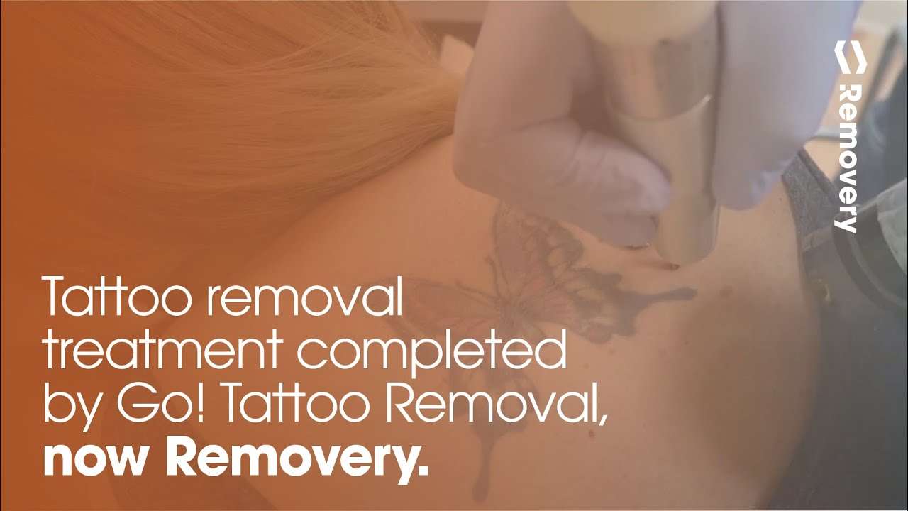Laser Tattoo Removal On Butterfly With Medlite C6 ...