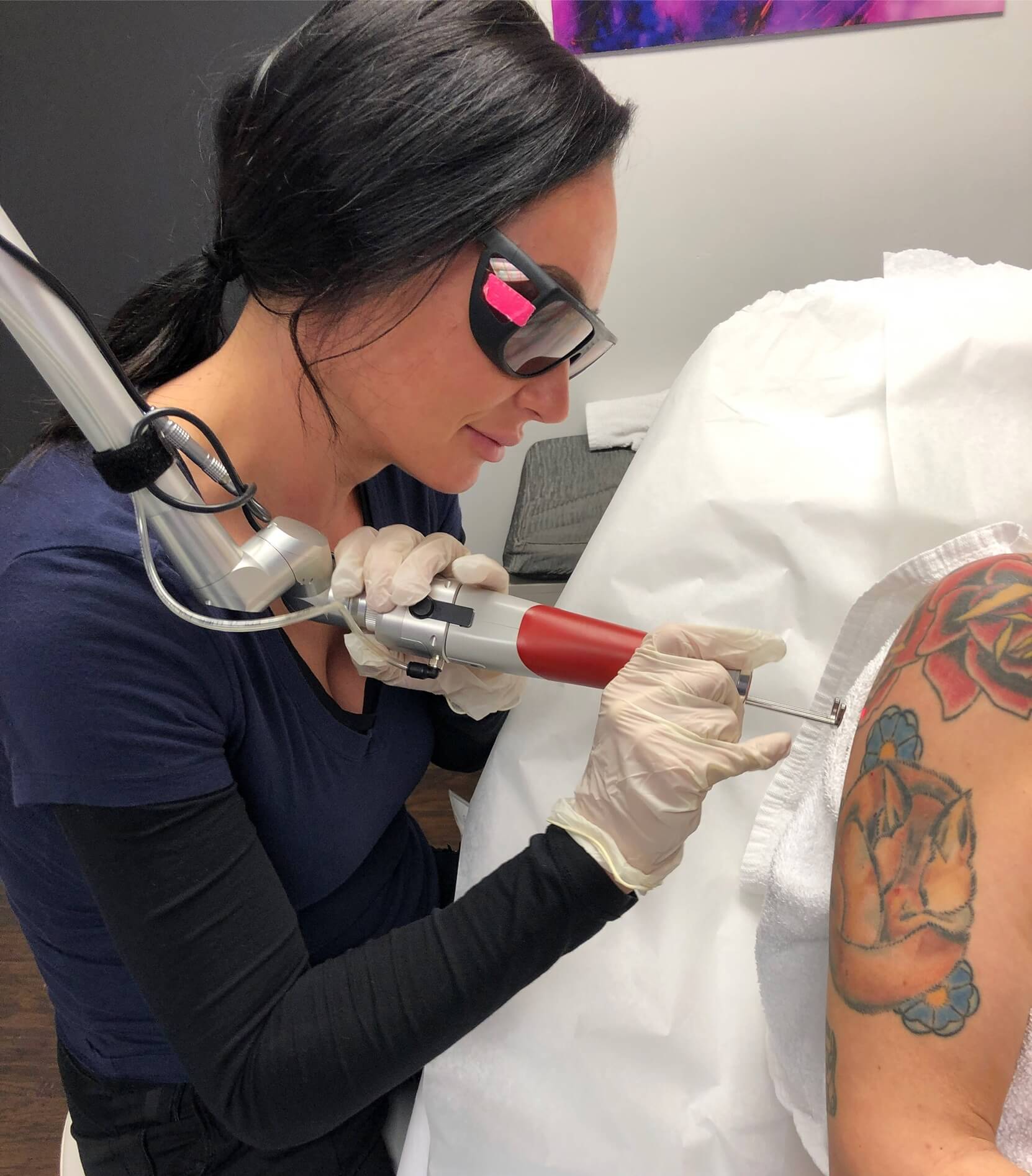 Laser Tattoo Removal Training Michigan