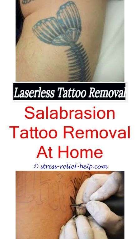 Laser tattoo removal uk.Can you get an indian ink tattoo ...