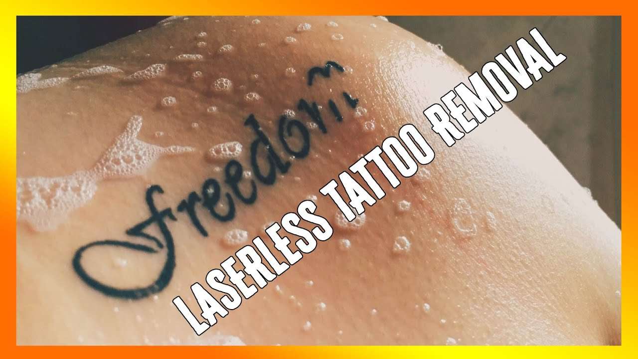 Laserless tattoo removal guide review