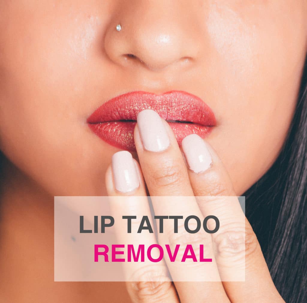 Lip Tattoo Removal: How to Get Permanent Lip Makeup Removed?