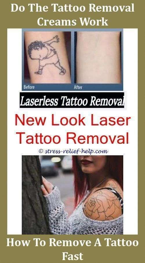 Low Cost Tattoo Removal Hat Khloe Tätowierung entfernt ...