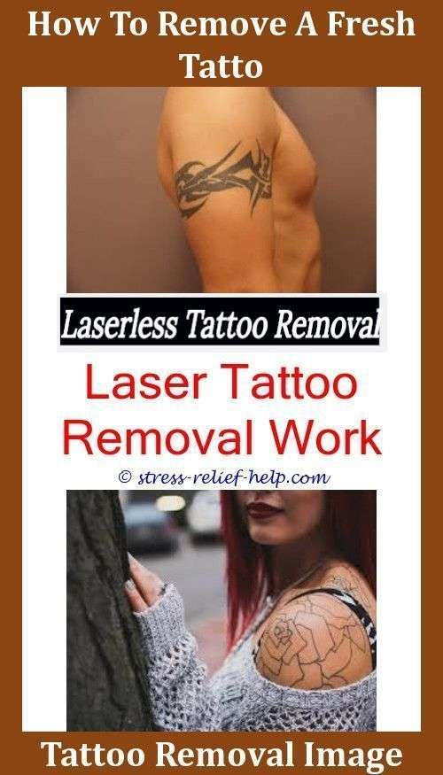 Low Cost Tattoo Removal How Badly Does Laser Tattoo Removal Hurt Laser ...