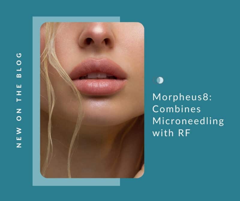 Morpheus8: Technology Combines Microneedling with RF