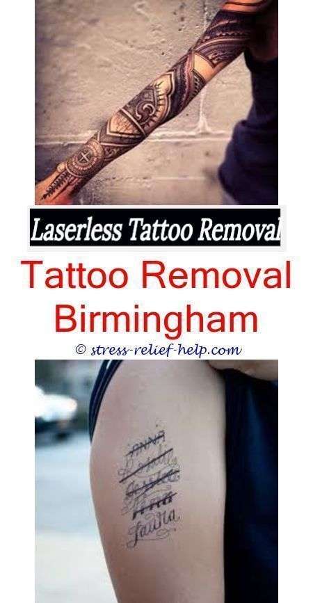 most effective tattoo removal how much is tattoo removal ...