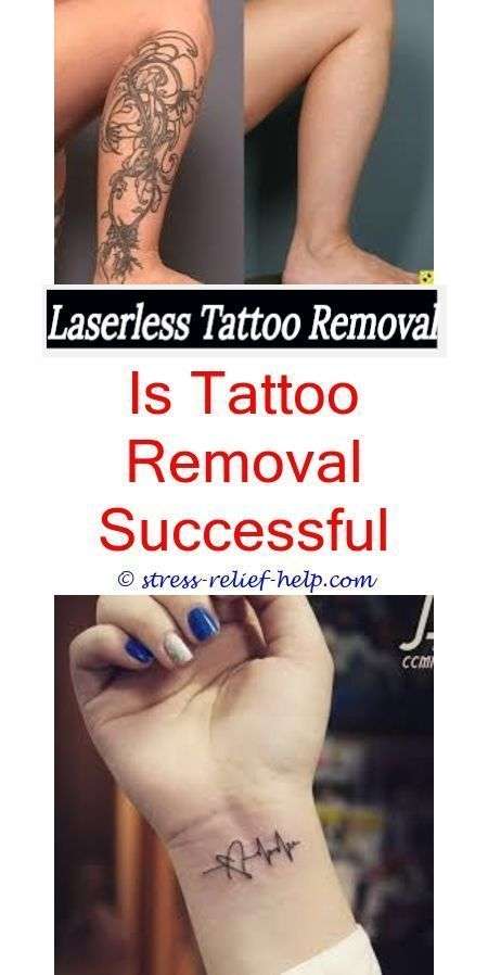 most effective tattoo removal how often tattoo removal