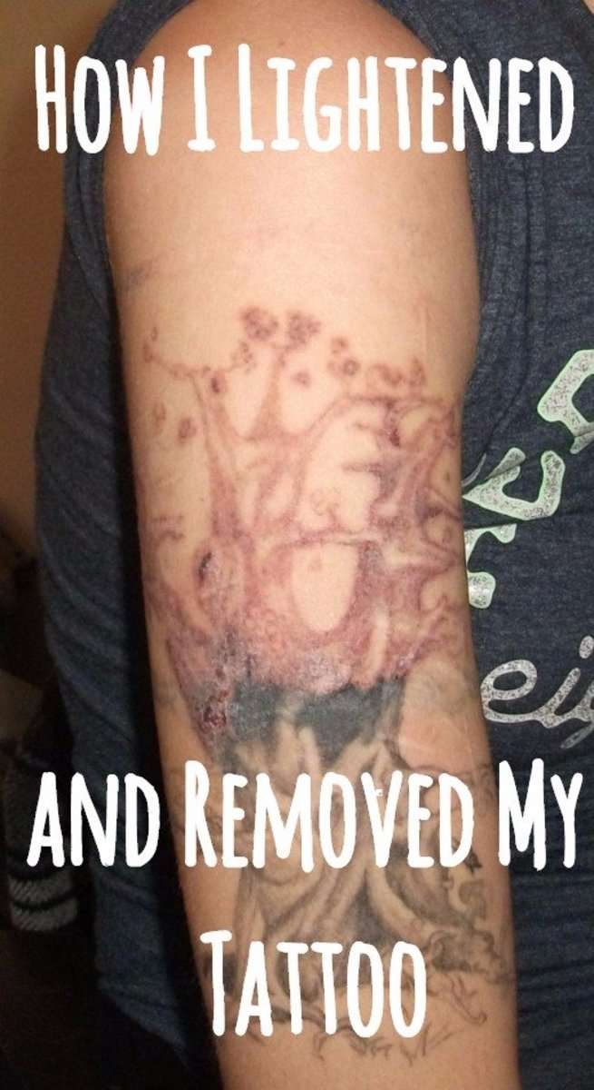 My Experience Lightening and Removing My Tattoo at Home