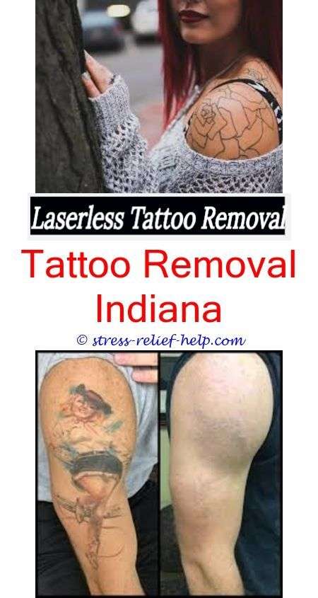 New tattoo removal.Does laser tattoo removal work 100.How ...