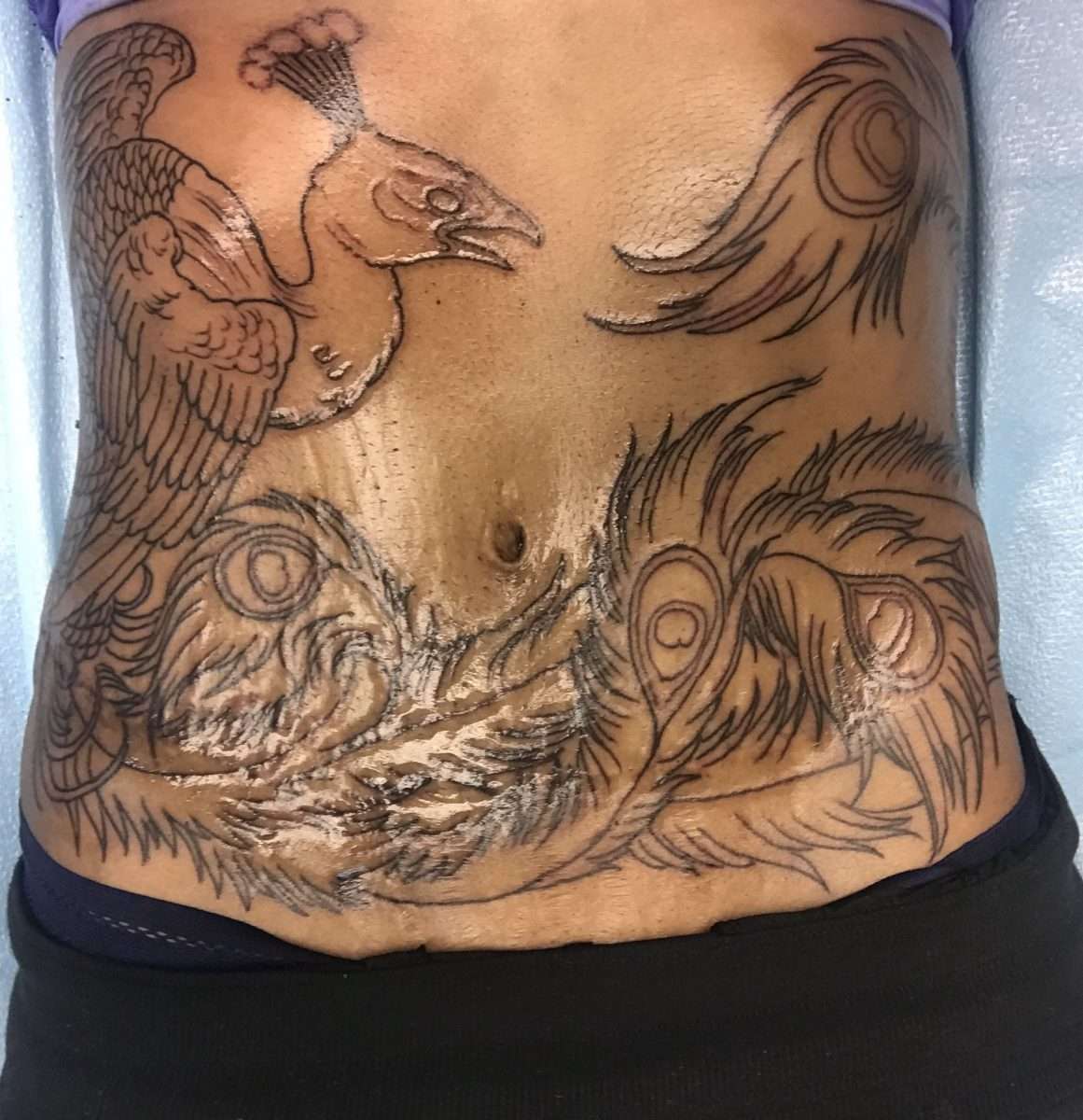 Outline done. Tummy tuck scar cover up! #tummytuck #pheonix #lovemyink ...