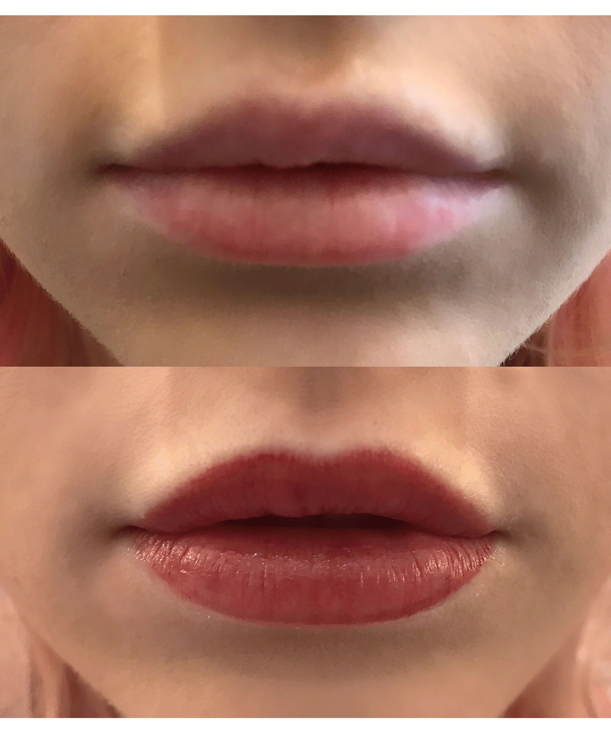 Permanent Lip Color Tattoo Experience Photos
