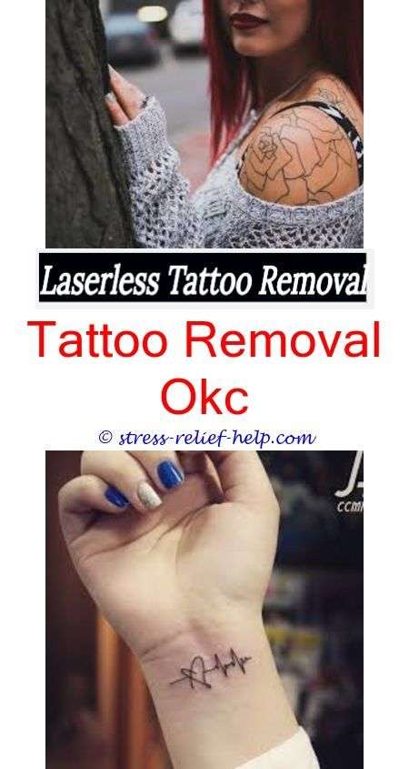 Pin auf Tattoo Removal