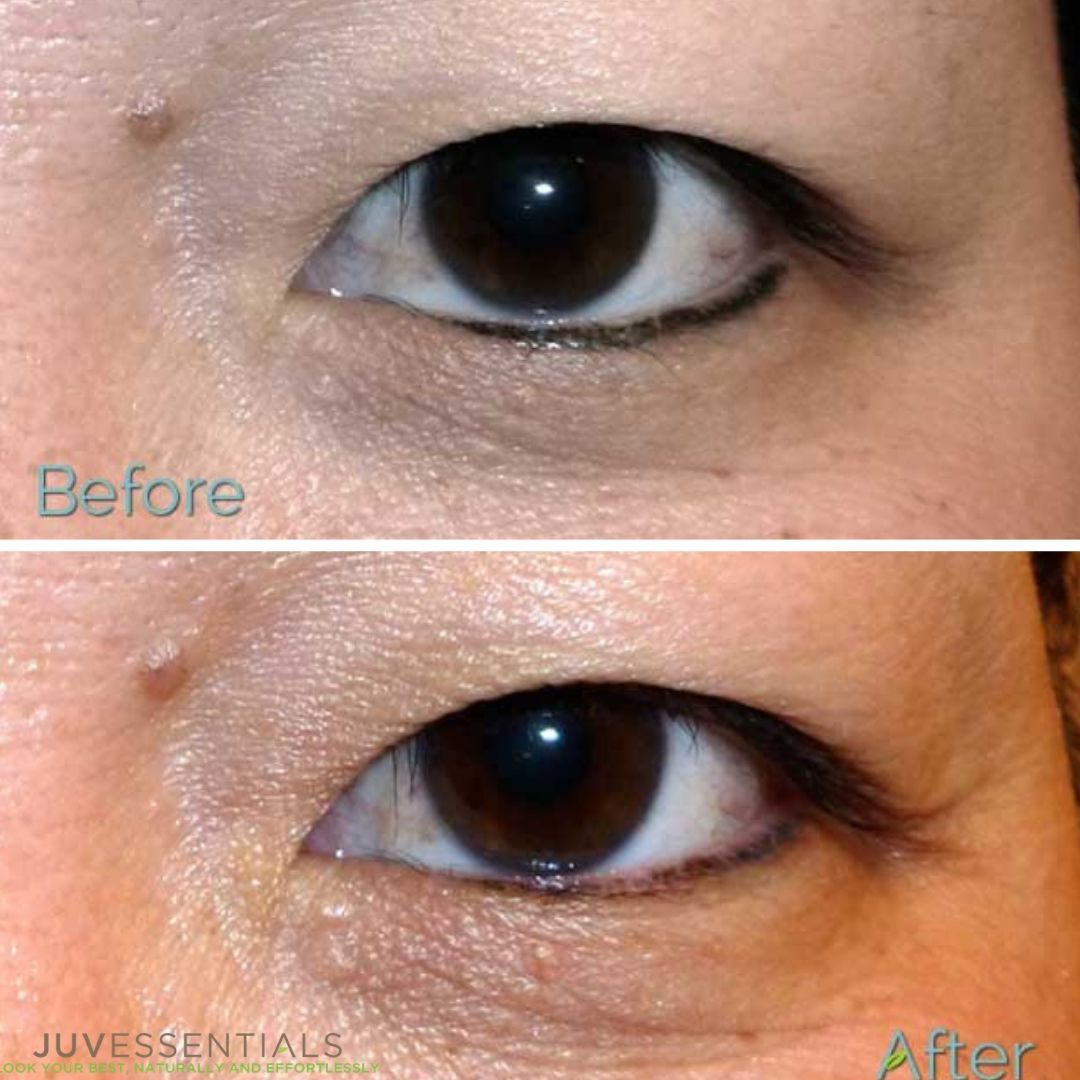 Pin on Before and After Permanent Makeup