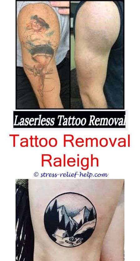Pin on Tattoo Laser Treatment