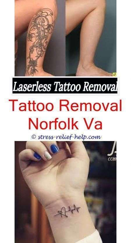 Pin on Tattoo Removal