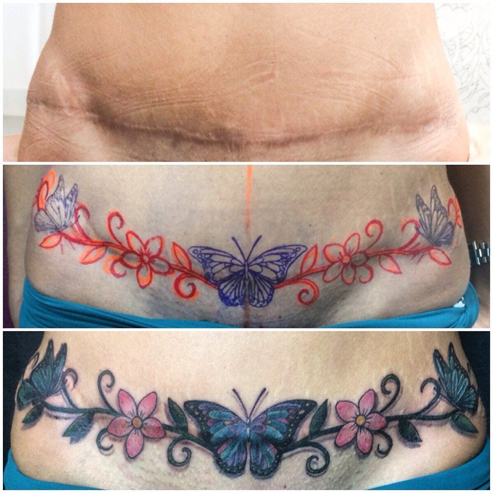 Pin on tummy tuck tatoo cover up designs