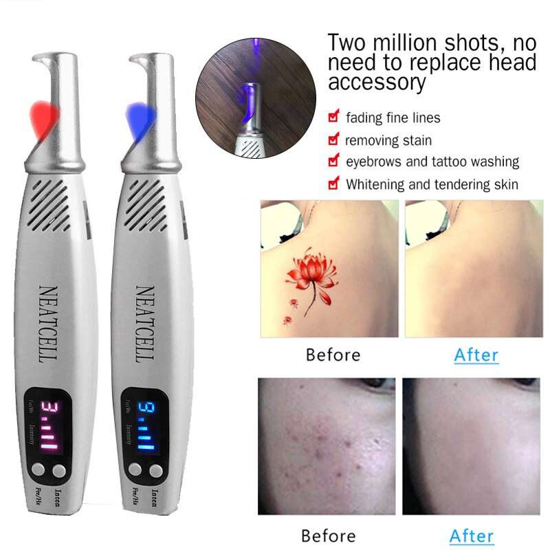 Portable Face Blemish Remover Picosecond Laser Pen Removal Freckle ...