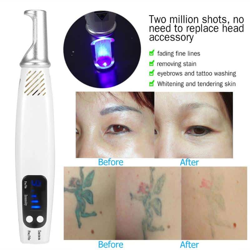 Pro Laser Picosecond Pen Blue& Red Remove Tattoo Laser Pen Freckle Acne ...