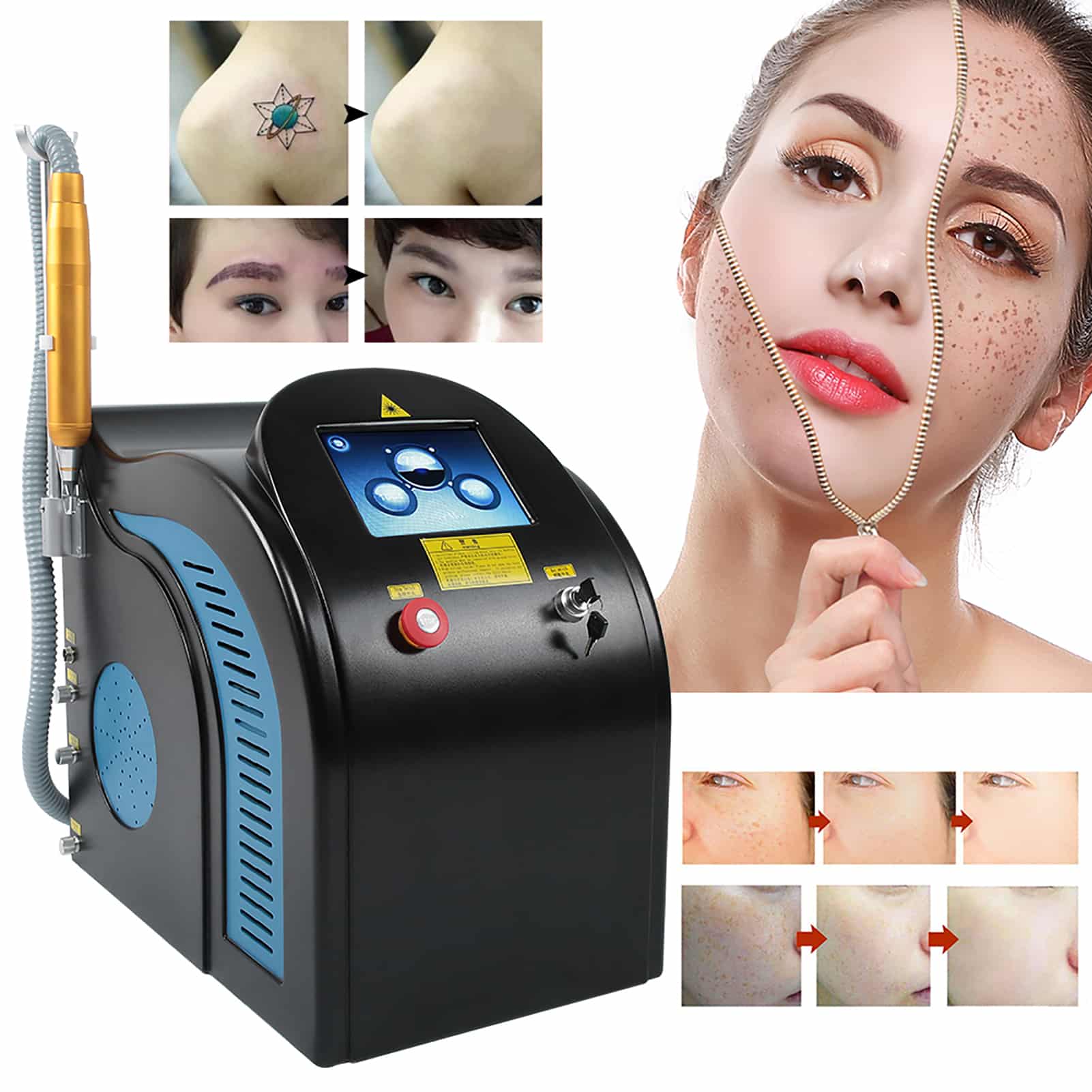 Professional Nd Yag Laser Whitening Skin Pigment Laser Tattoo Removal ...