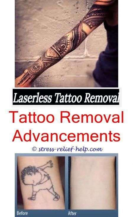 Remove tattoo yourself.Tattoo removal san antonio tx.Small ...
