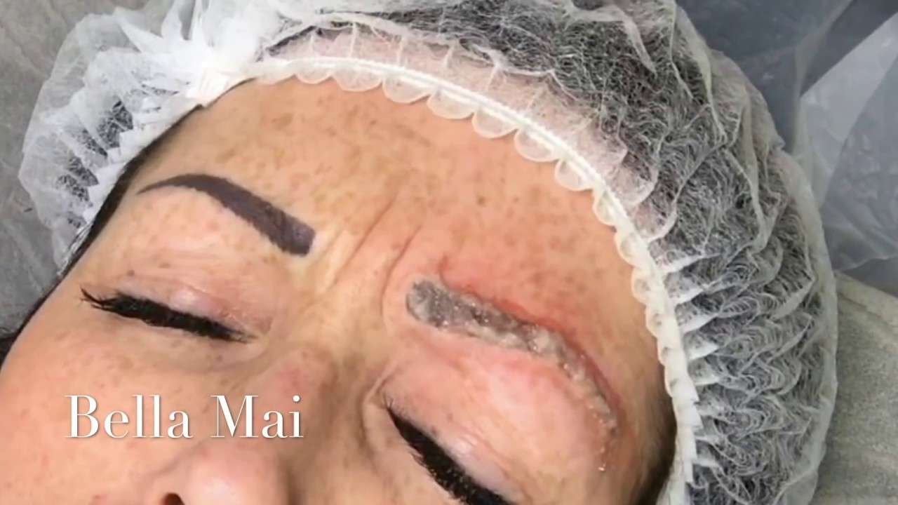 Saline Solution To Remove Permanent Makeup