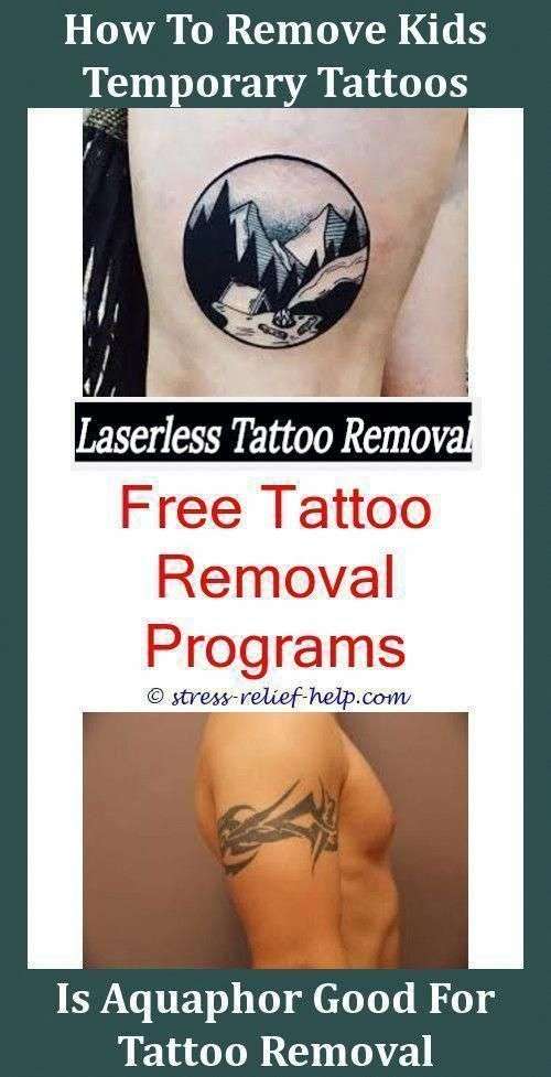 Surgical Tattoo Removal Tattoo And Scar Removal,how effective is tattoo ...