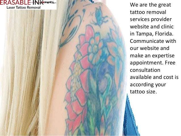 Tampa Laser Tattoo Removal